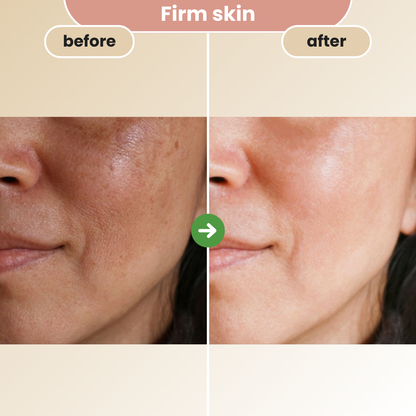 before and after using glowytouch facial brush